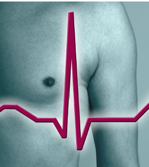 EKG lesen